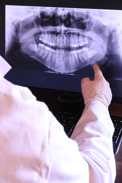 Best Broken or Cracked Tooth Emergency Dentist in Cedarburg, WI